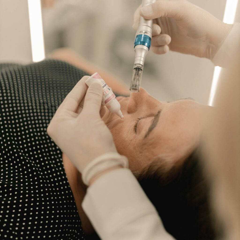 pexels-photo-29648626-29648626 Close-up of person receiving microneedling beauty treatment in a clinic.